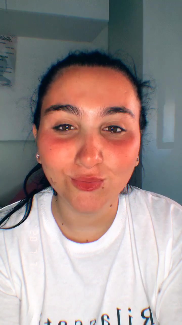 @A🍒L🍒E