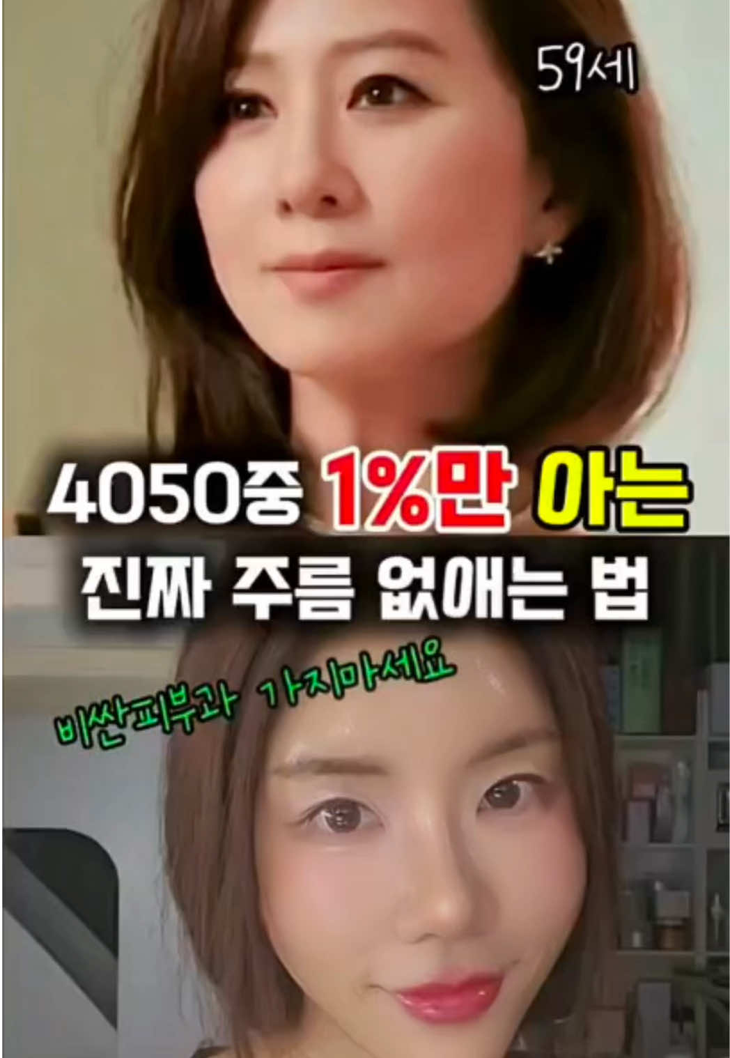 @지나스 GINAS