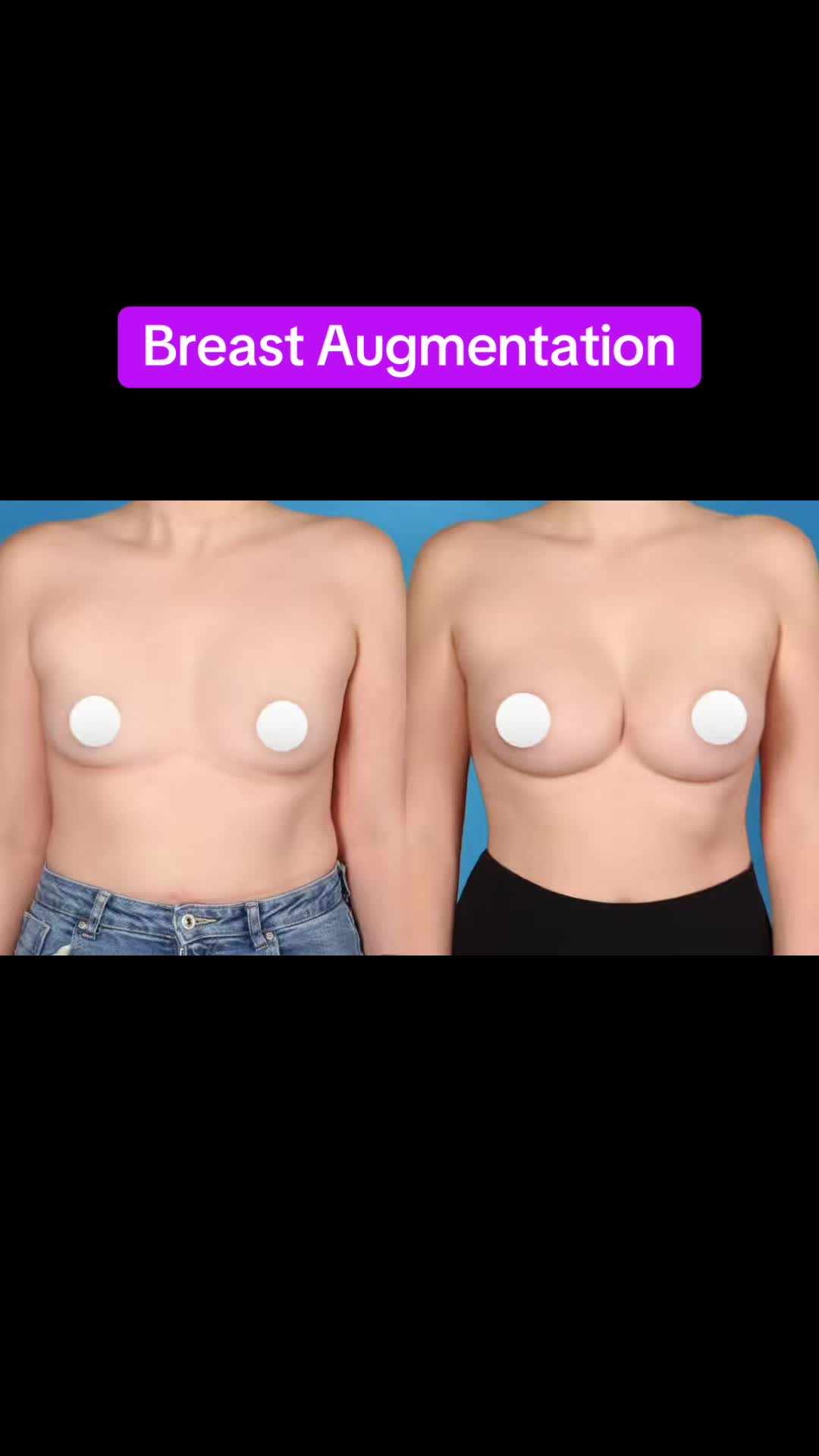 @Kelly&ensp;Killeen,&ensp;MD,&ensp;FACS
