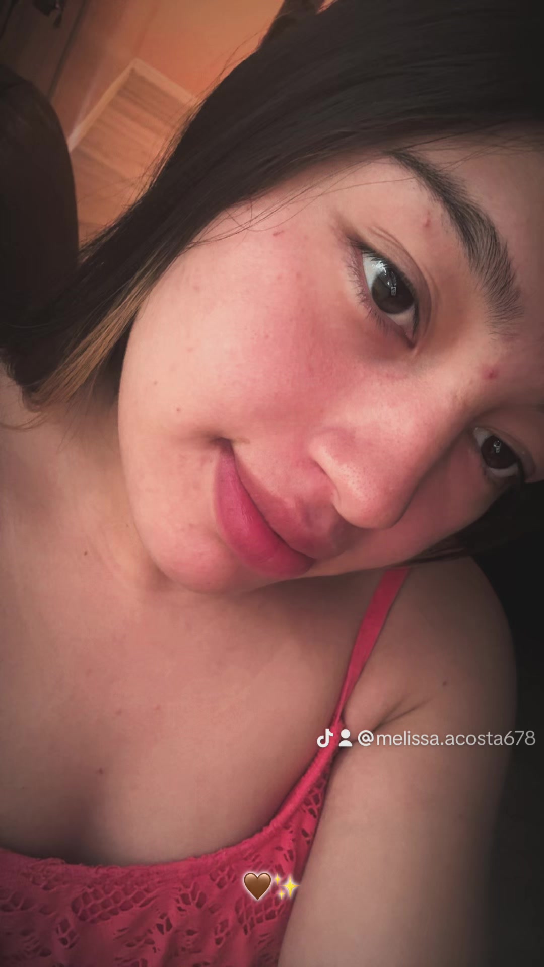 @Melissa Acosta