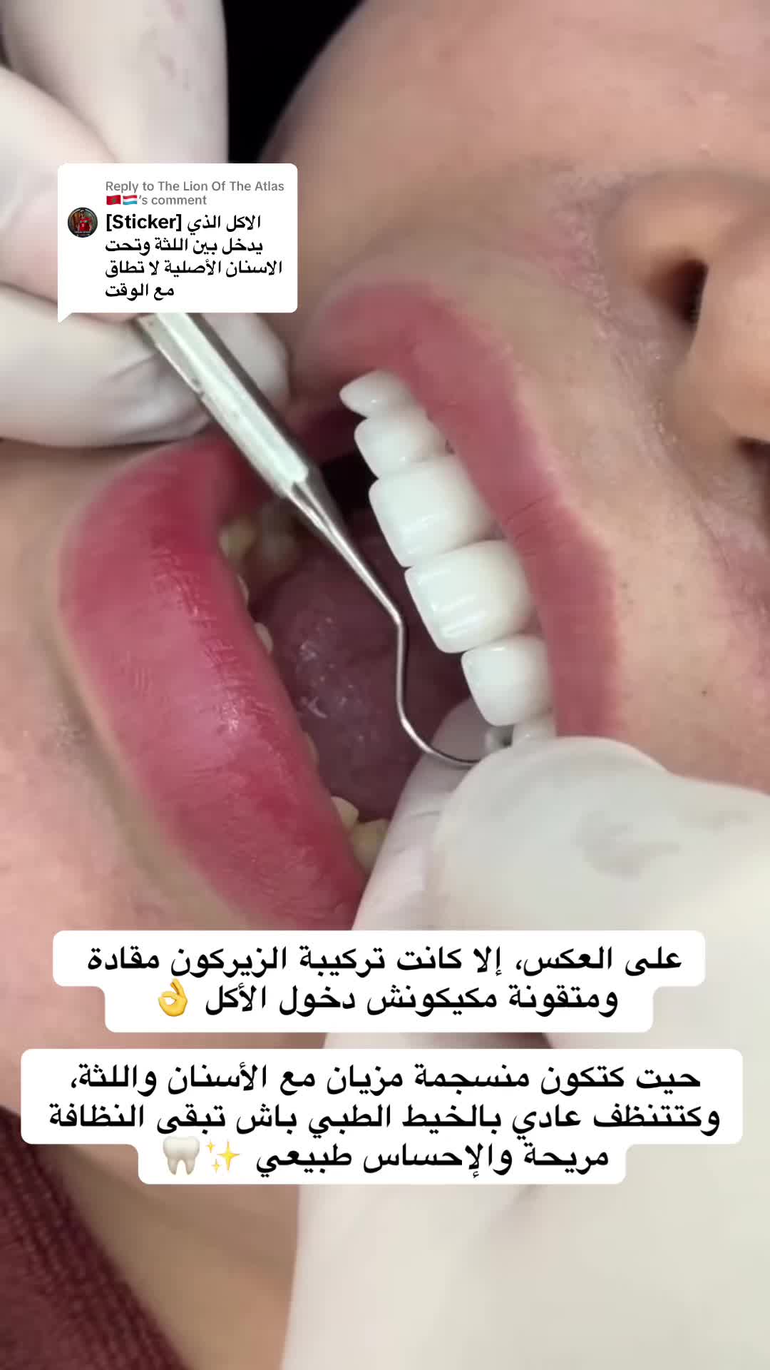 @brightsmileee1