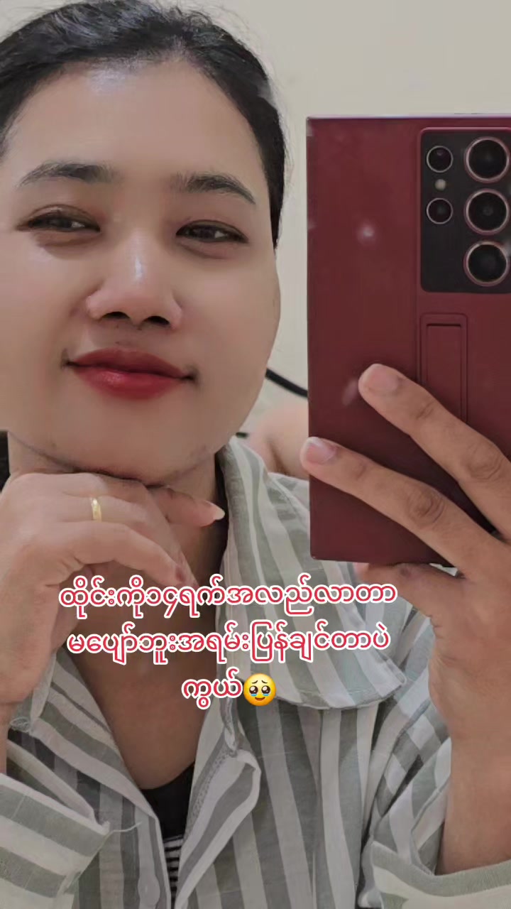 @♊️Daw Ei Mon 🇲🇲🇯🇵