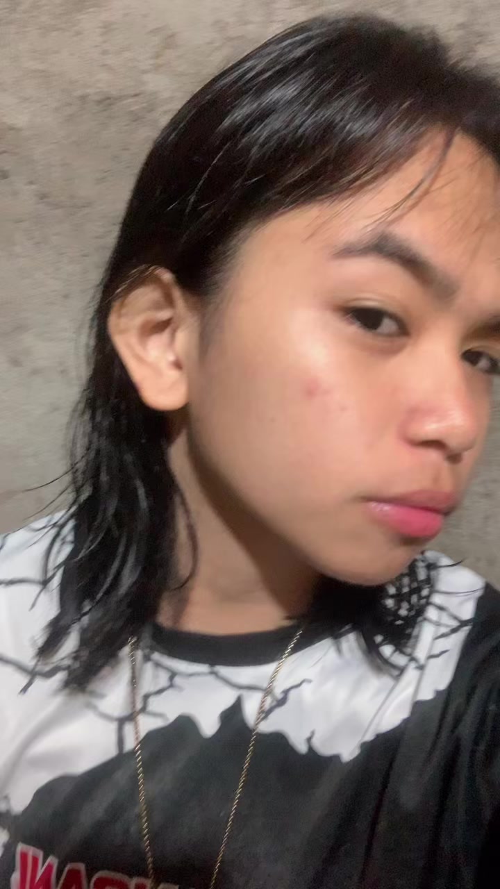 @Unoskiee