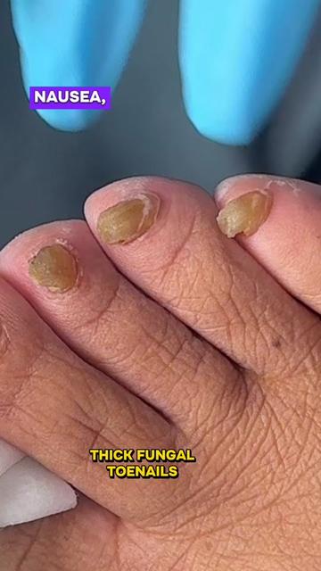 @Deniel Foot and Ankle Center