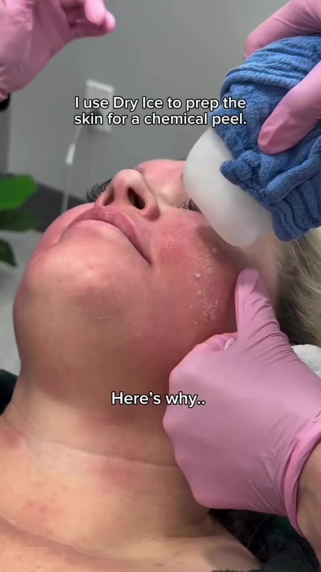 @Pure Skin OC