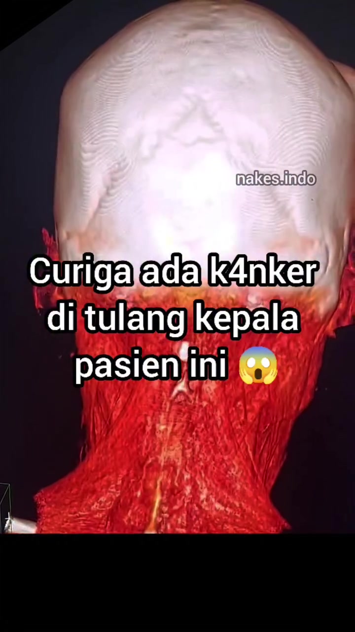 @Sobat Radiology