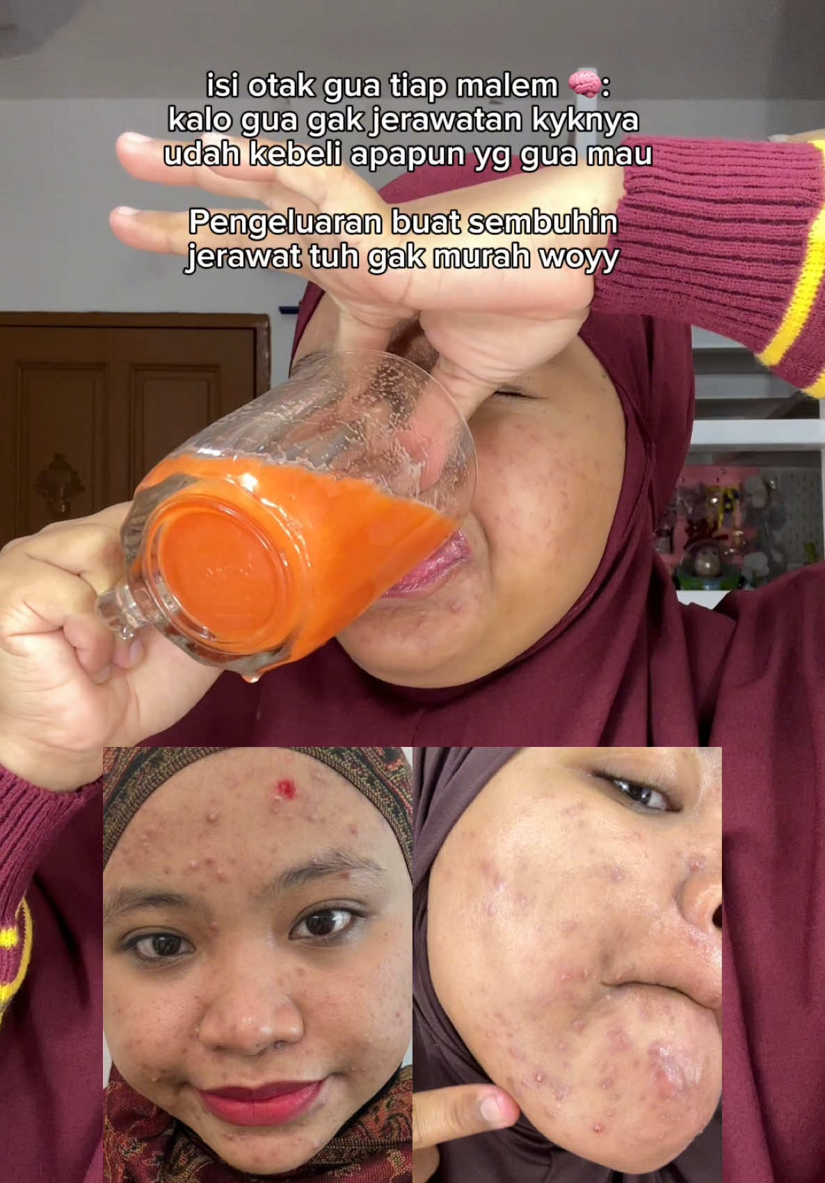 @MBAK CUNGCAT BAYI