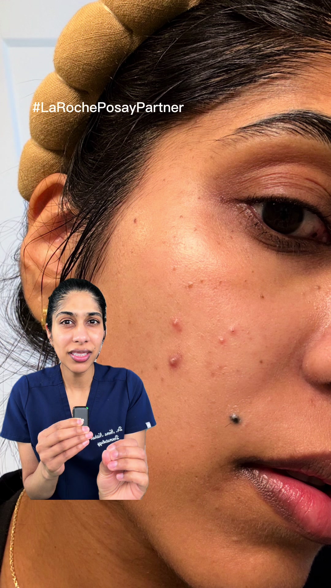 @Dr. Neera, Skin Surgeon