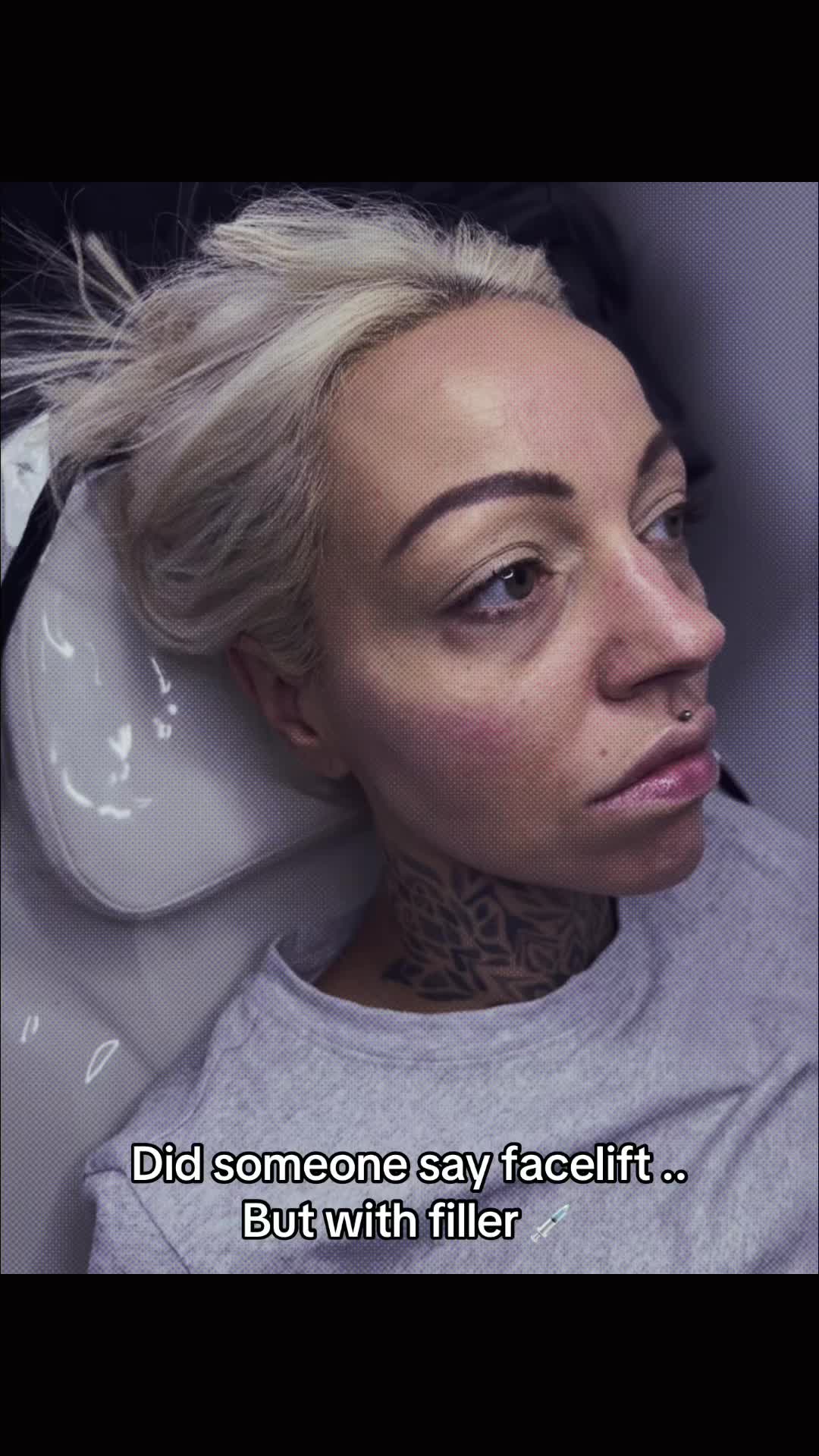 @Superfacial Aesthetics
