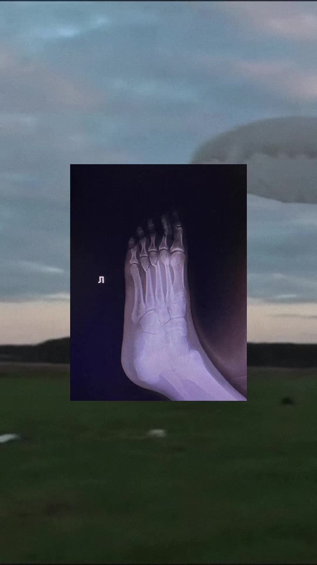 @₊<𝟑⋅˚‧✰ Вåва⋆♡ ̆̈✰₊⋆ッ
