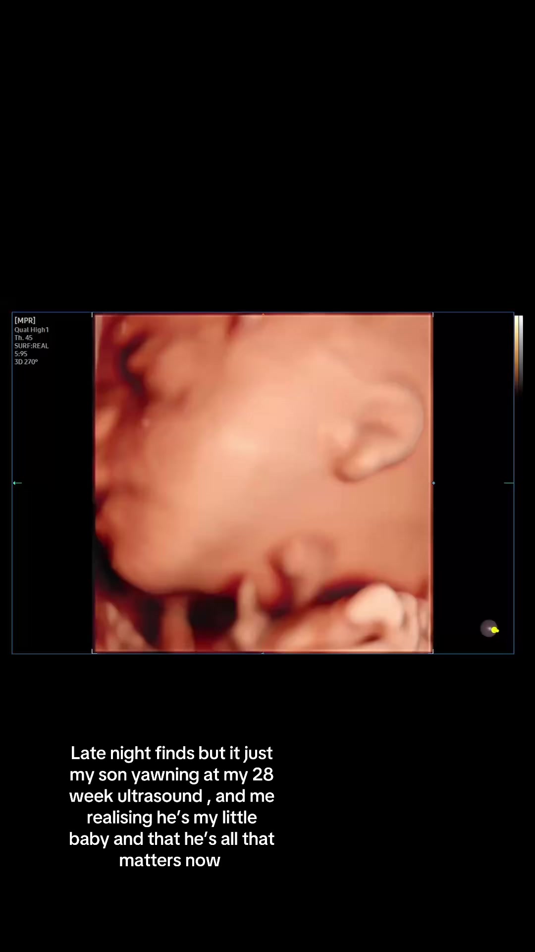 @𝒶𝓅𝓈.𝒷𝑜𝓎𝓂𝒶🩵👣