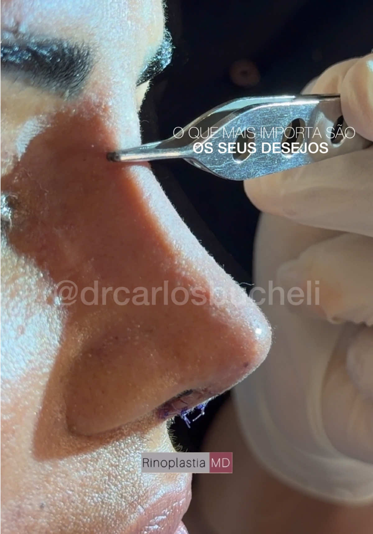 @Dr. Carlos Bucheli