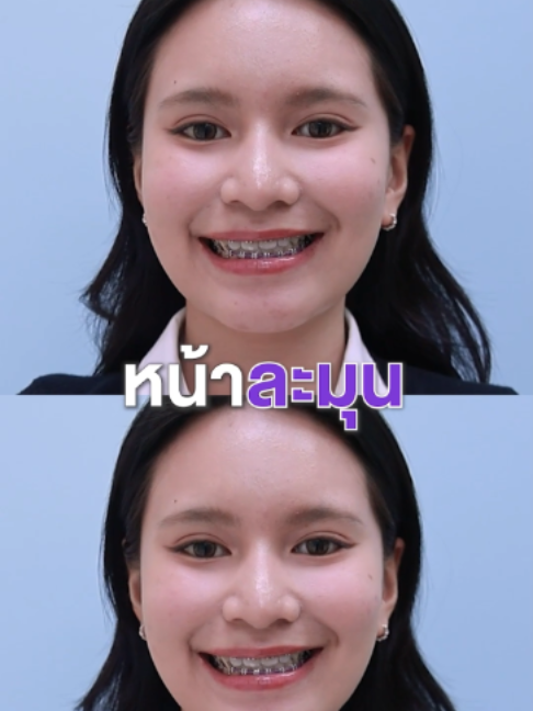 @โรงพยาบาลยันฮี