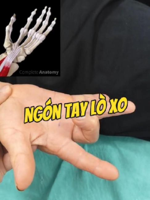@Chuyên gia xương khớp