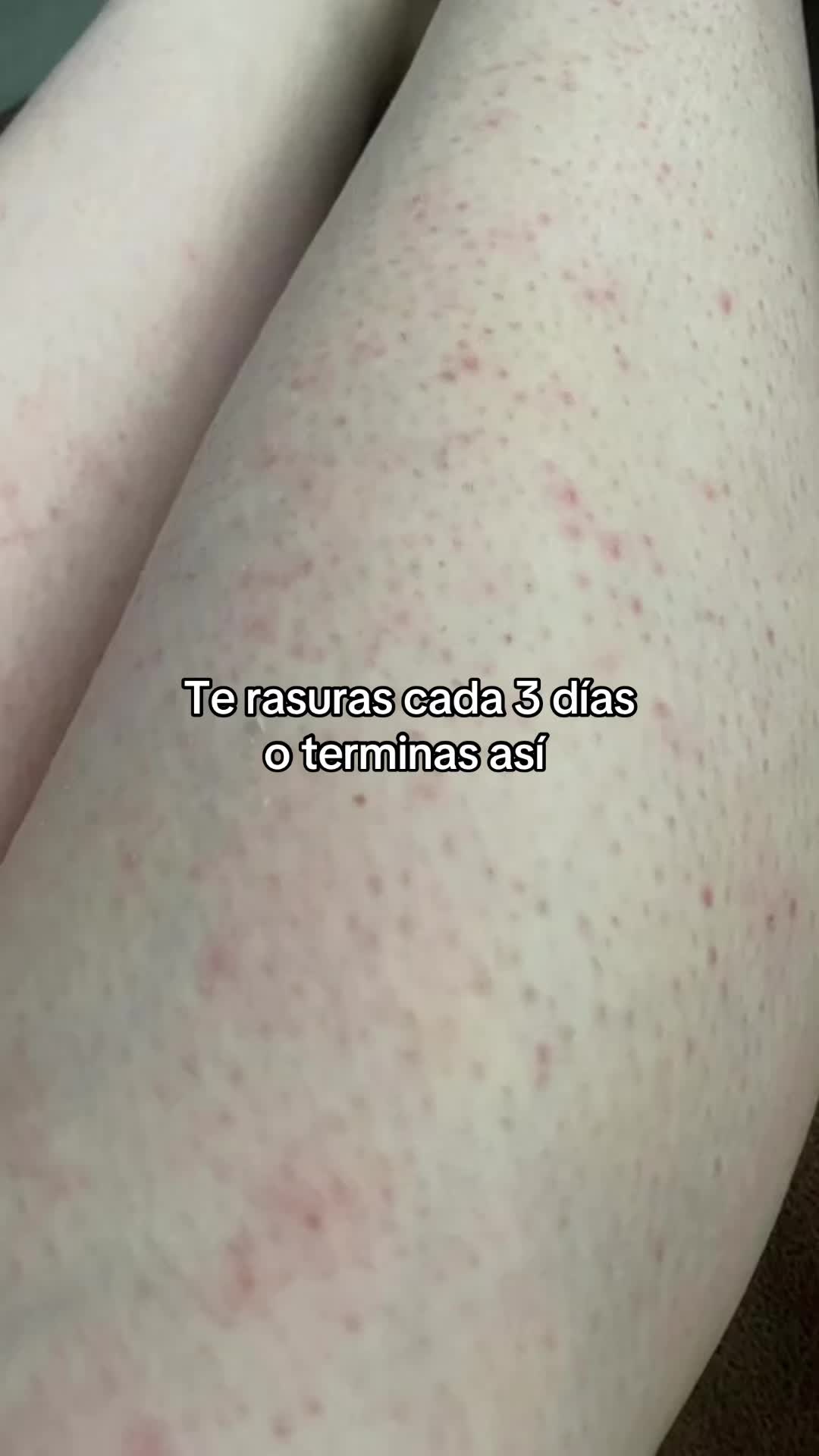 @Andy