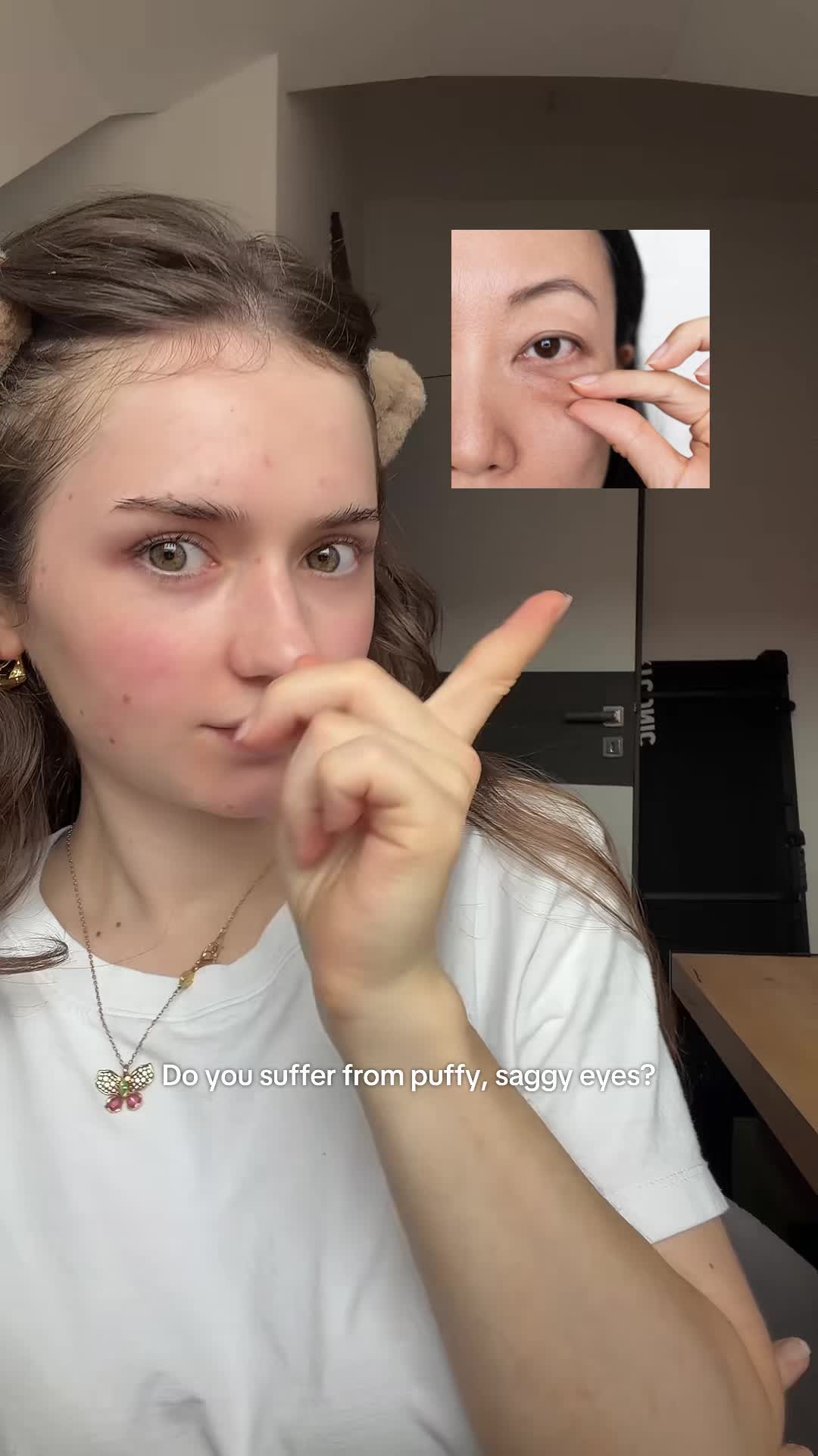 @australialix