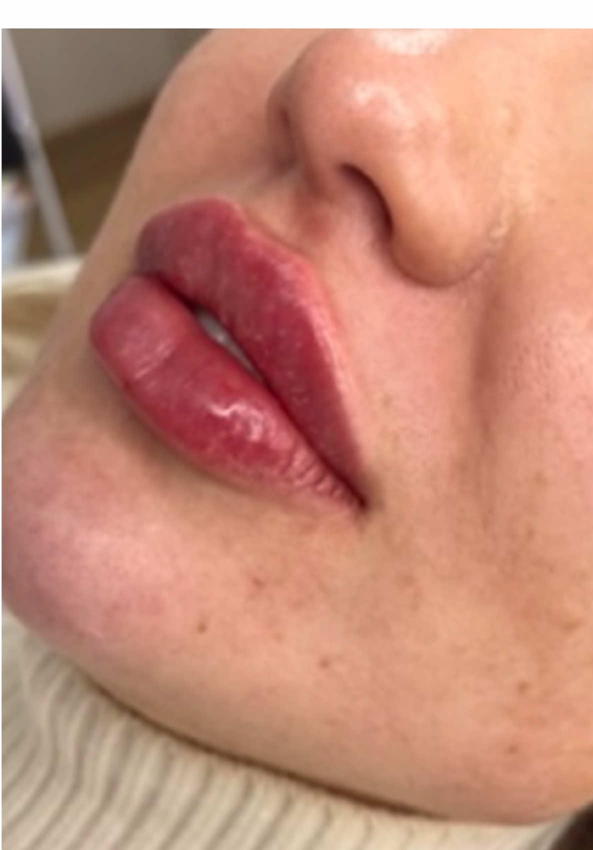 @DLuxe Aesthetics