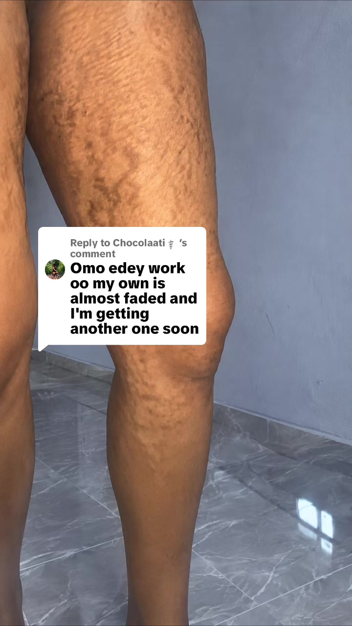 @Radiant skin