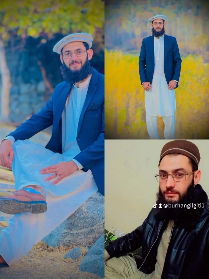 @Burhan Gilgiti