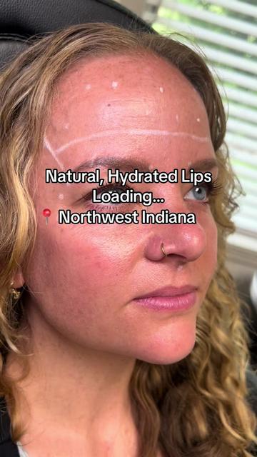 @Christy - NWI Aesthetic NP
