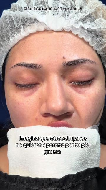 @drgarone.rinoplastia