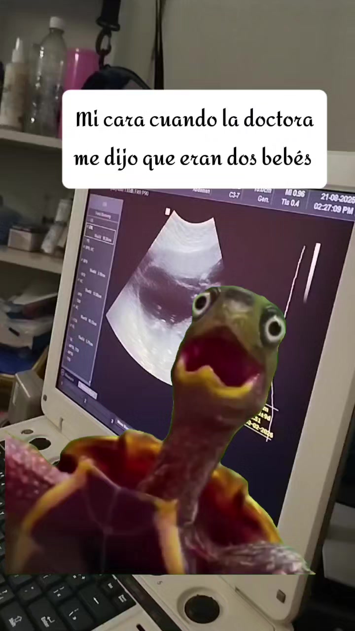 @Leiny Romero 🩵🩵🩷