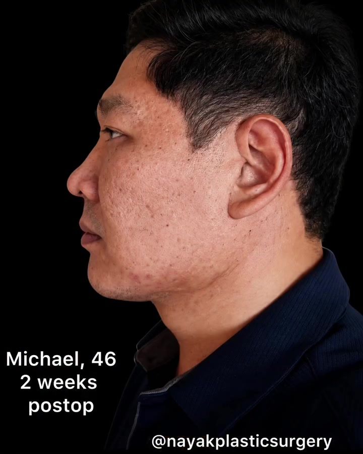@NayakPlasticSurgery