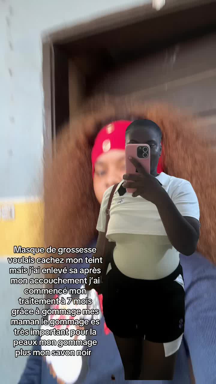 @🍒!😻nellygommage💆♀️🪸