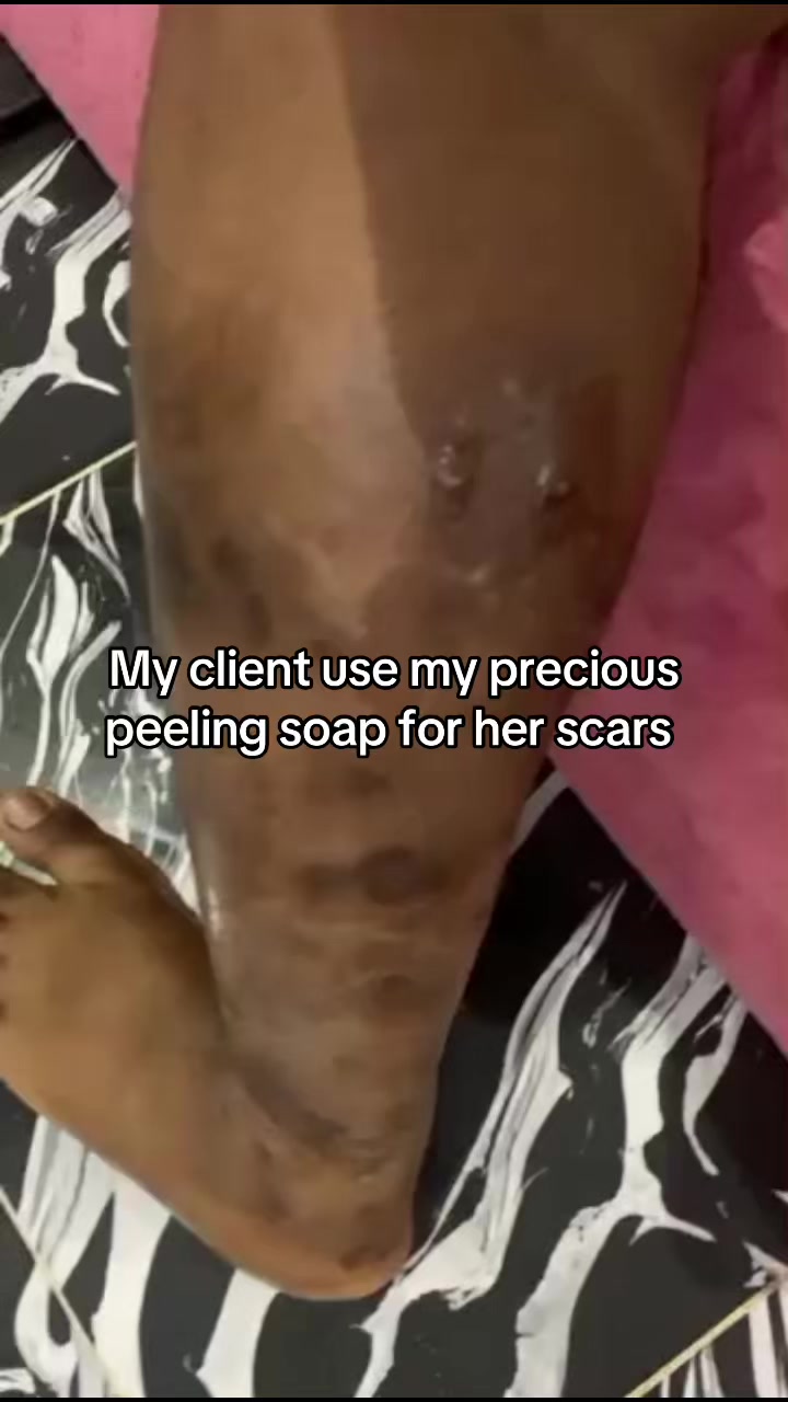 @@ Precious peeling soap