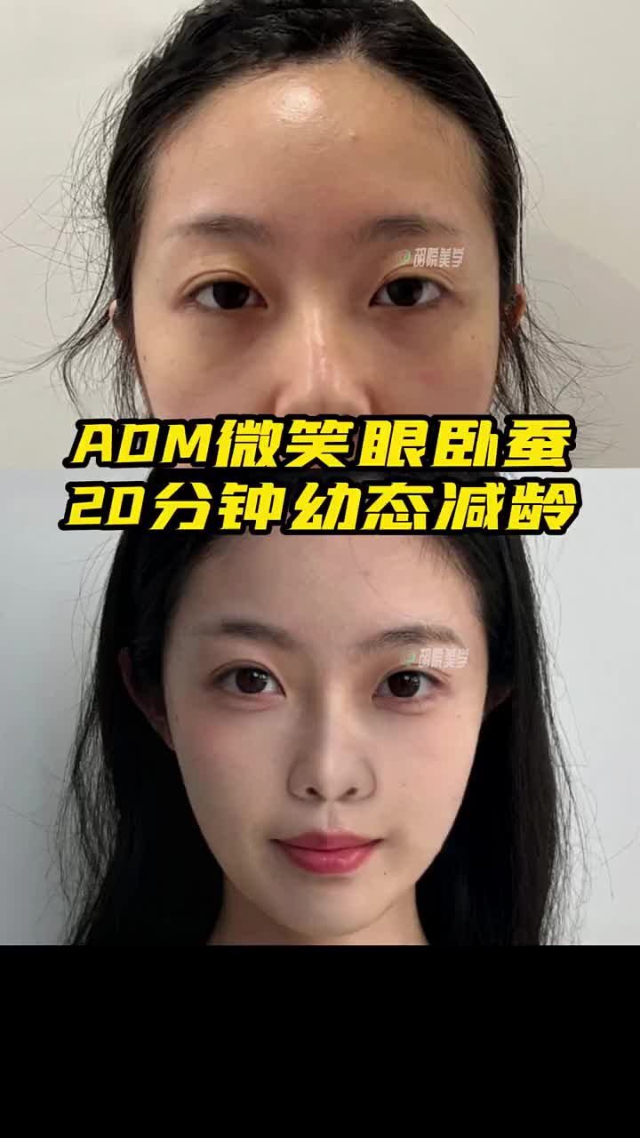 @Dr.HuJunJie