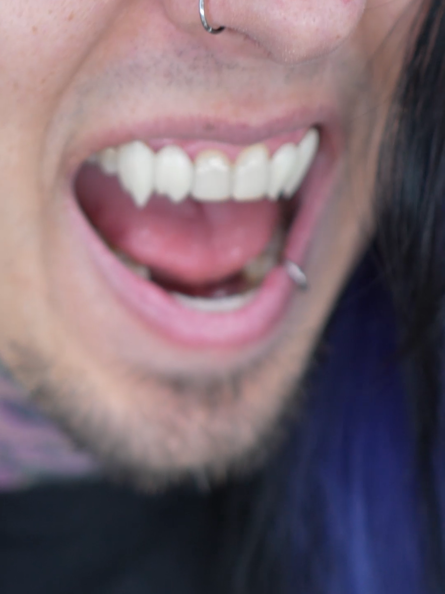 @bokuwahyde