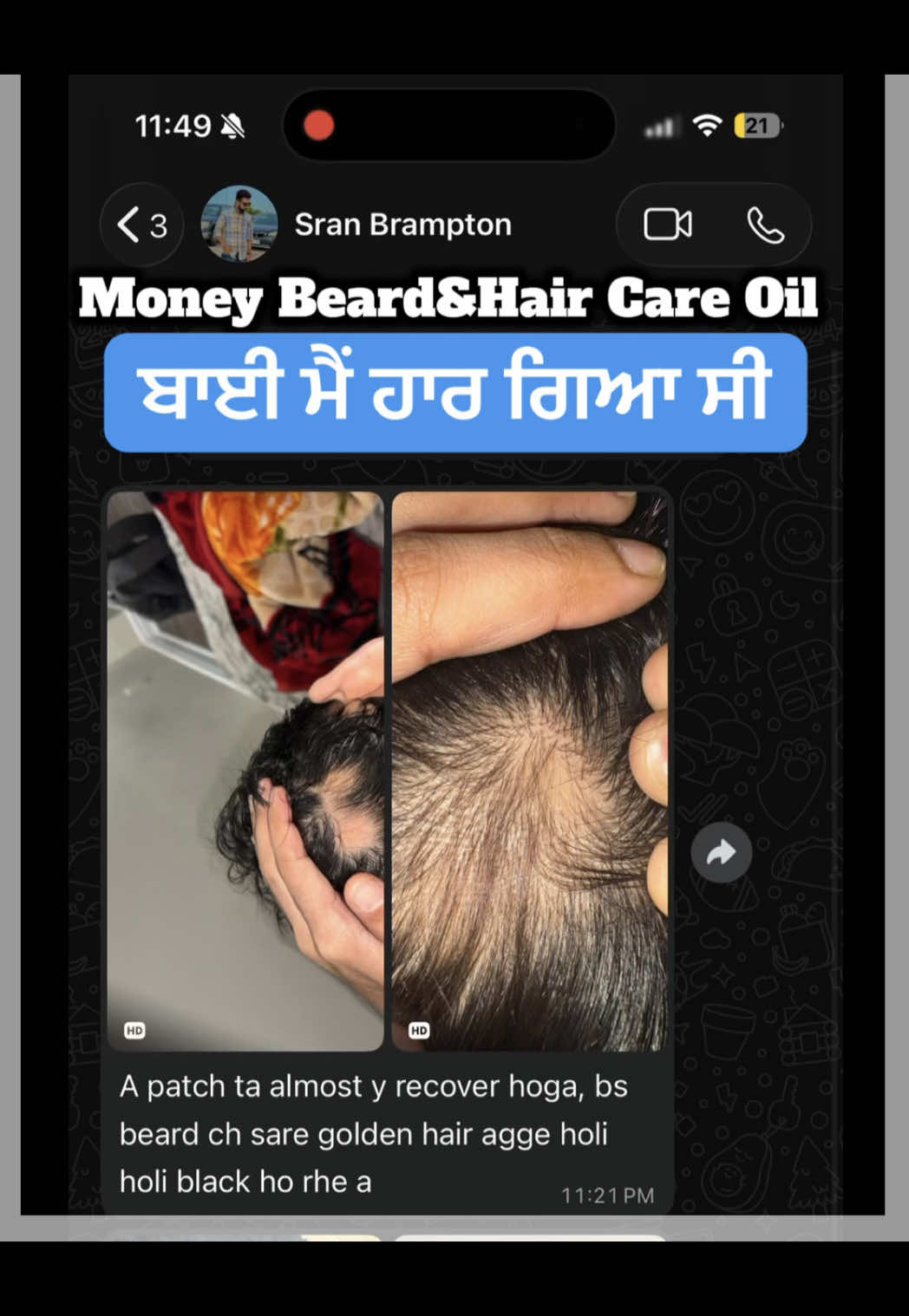 @money_beard_growthoil