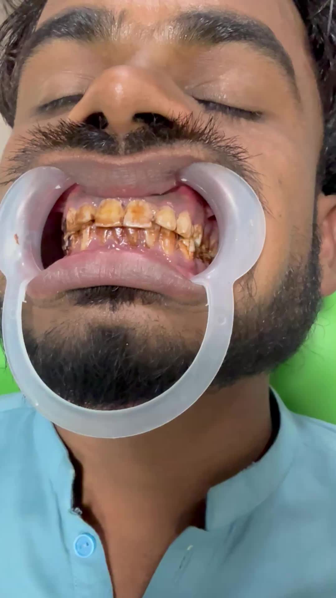 @Dr- syed numan official✅✅