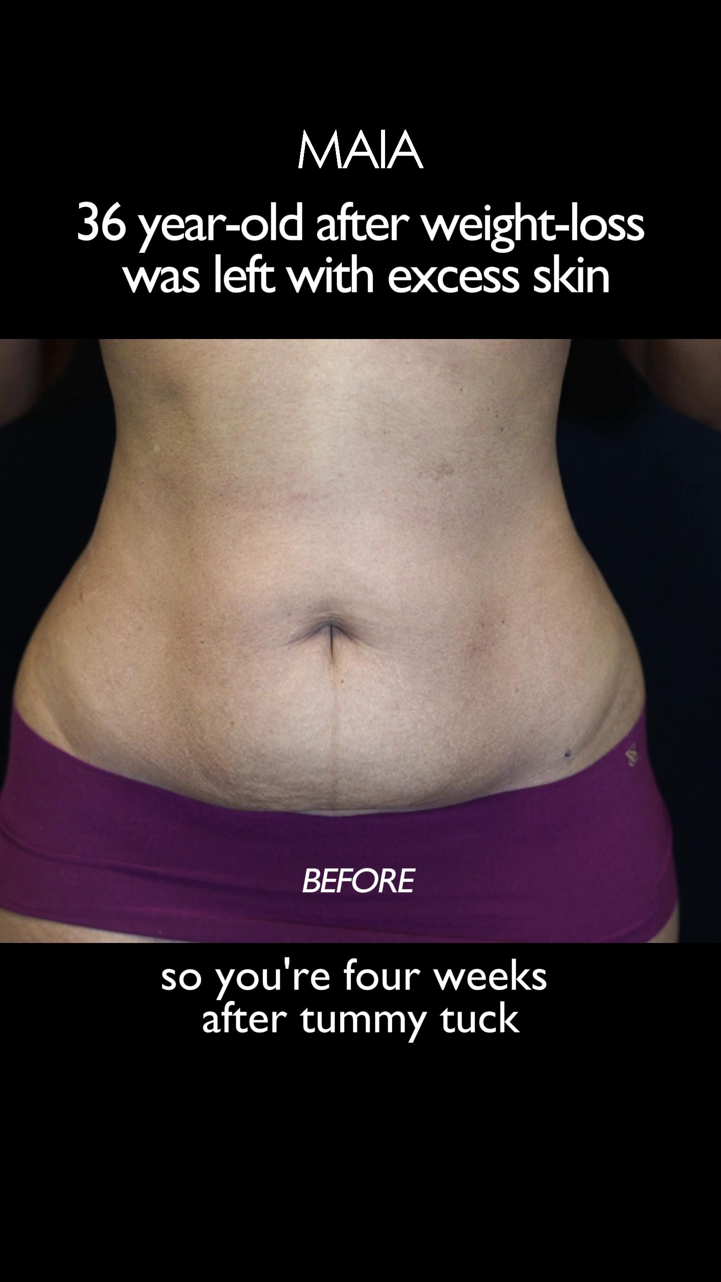 @Dr. Maia | Plastic Surgeon