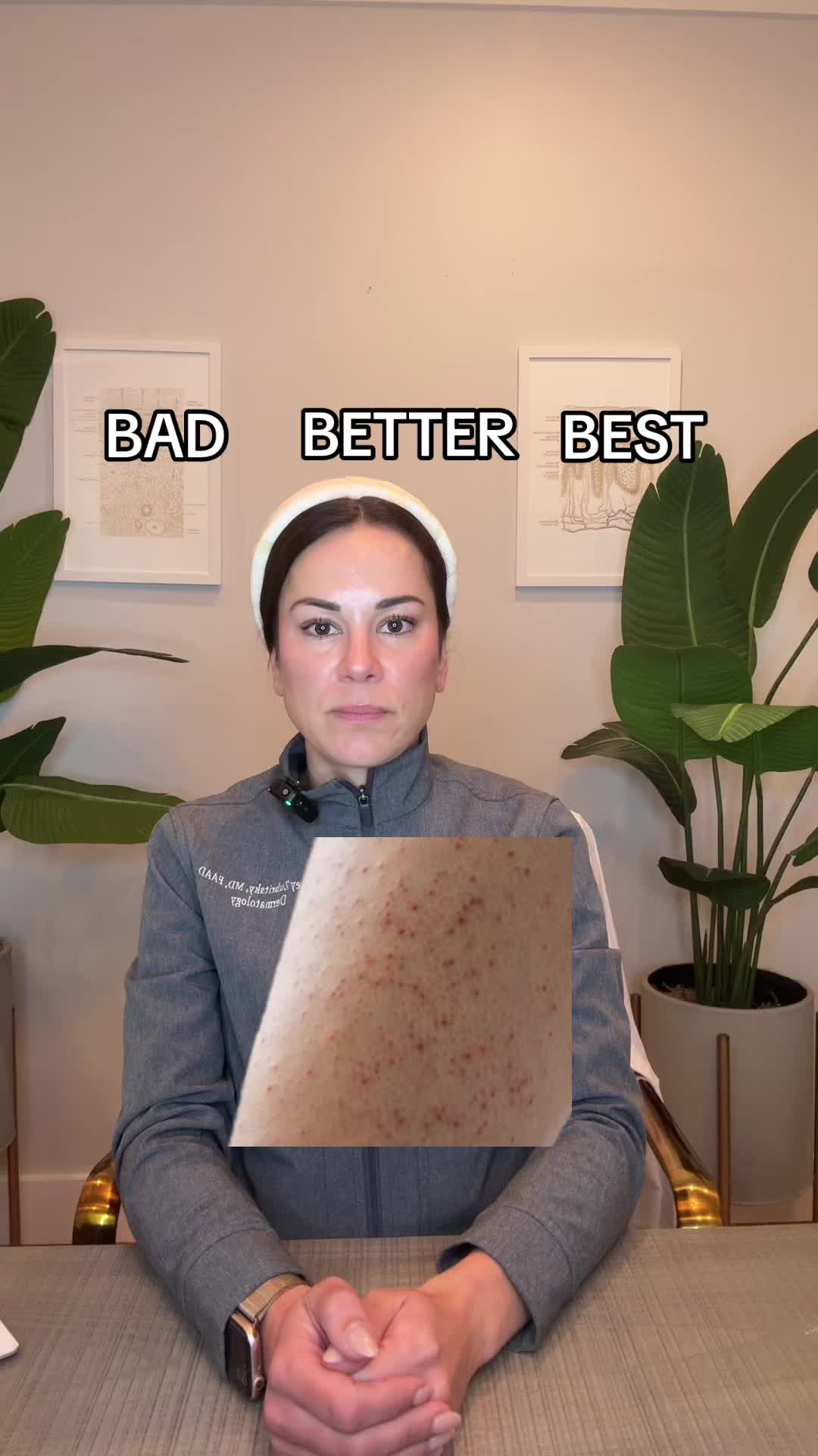 @Dermguru