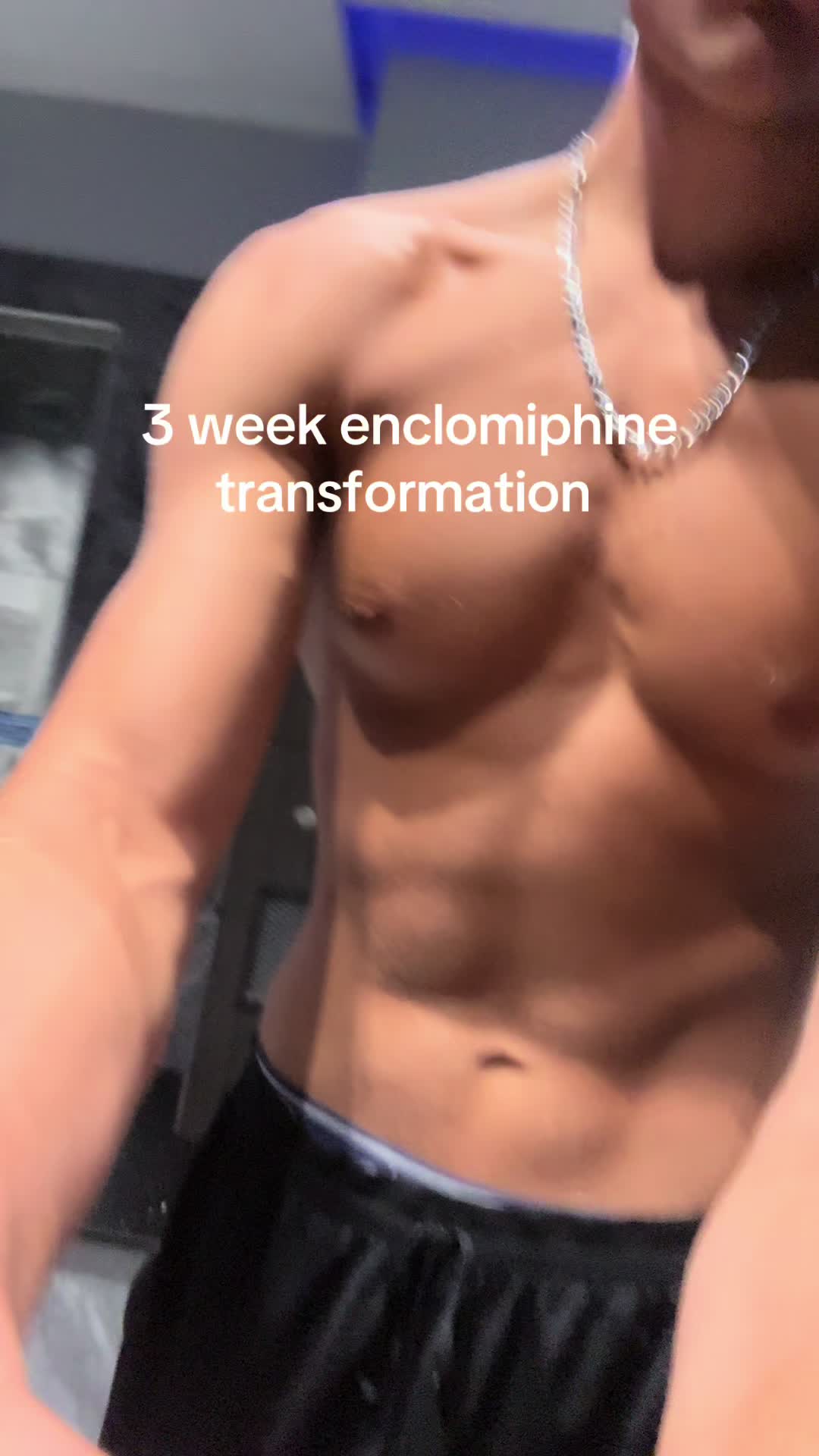 @chudlite