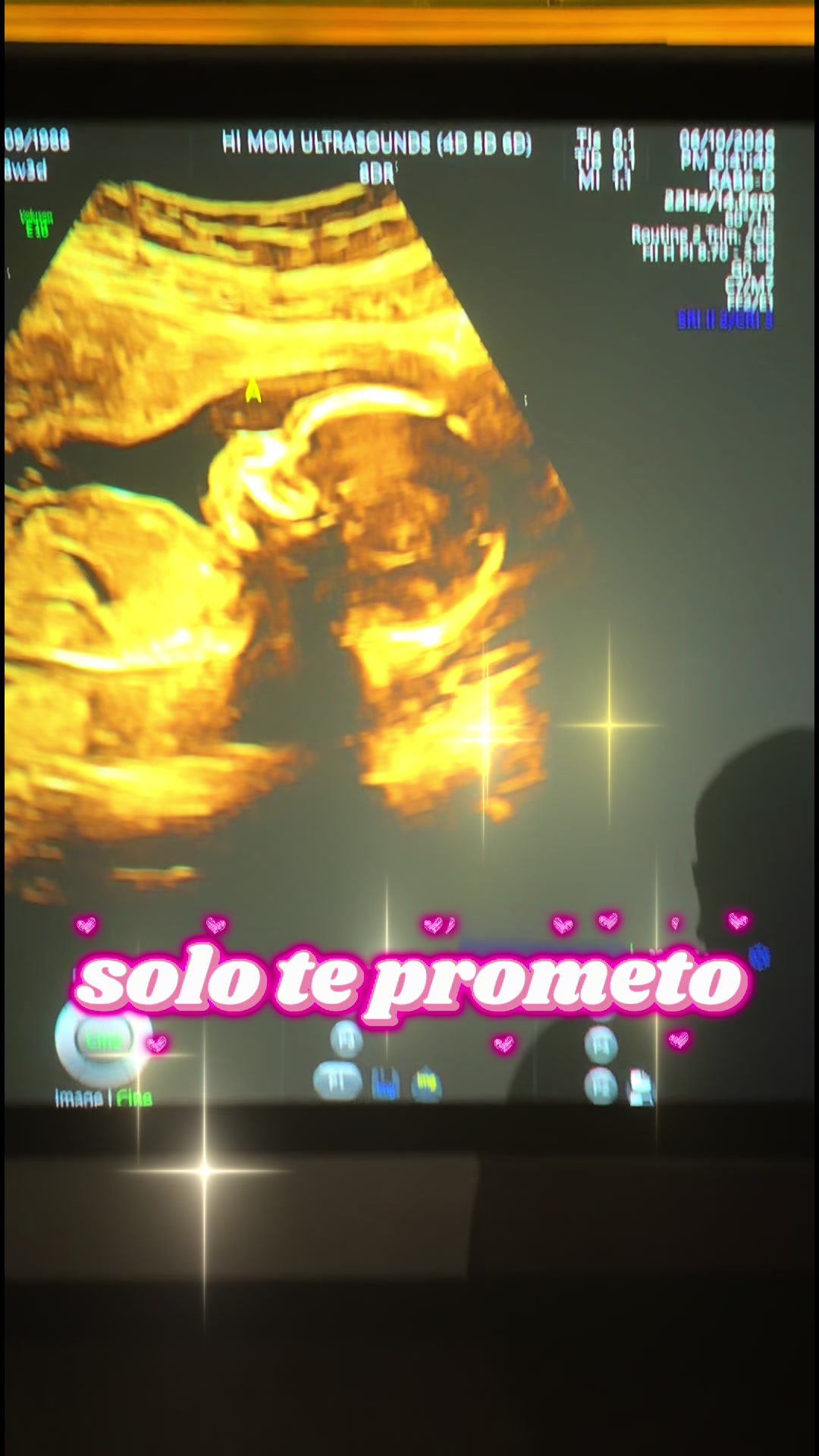 @Carmen Gomez
