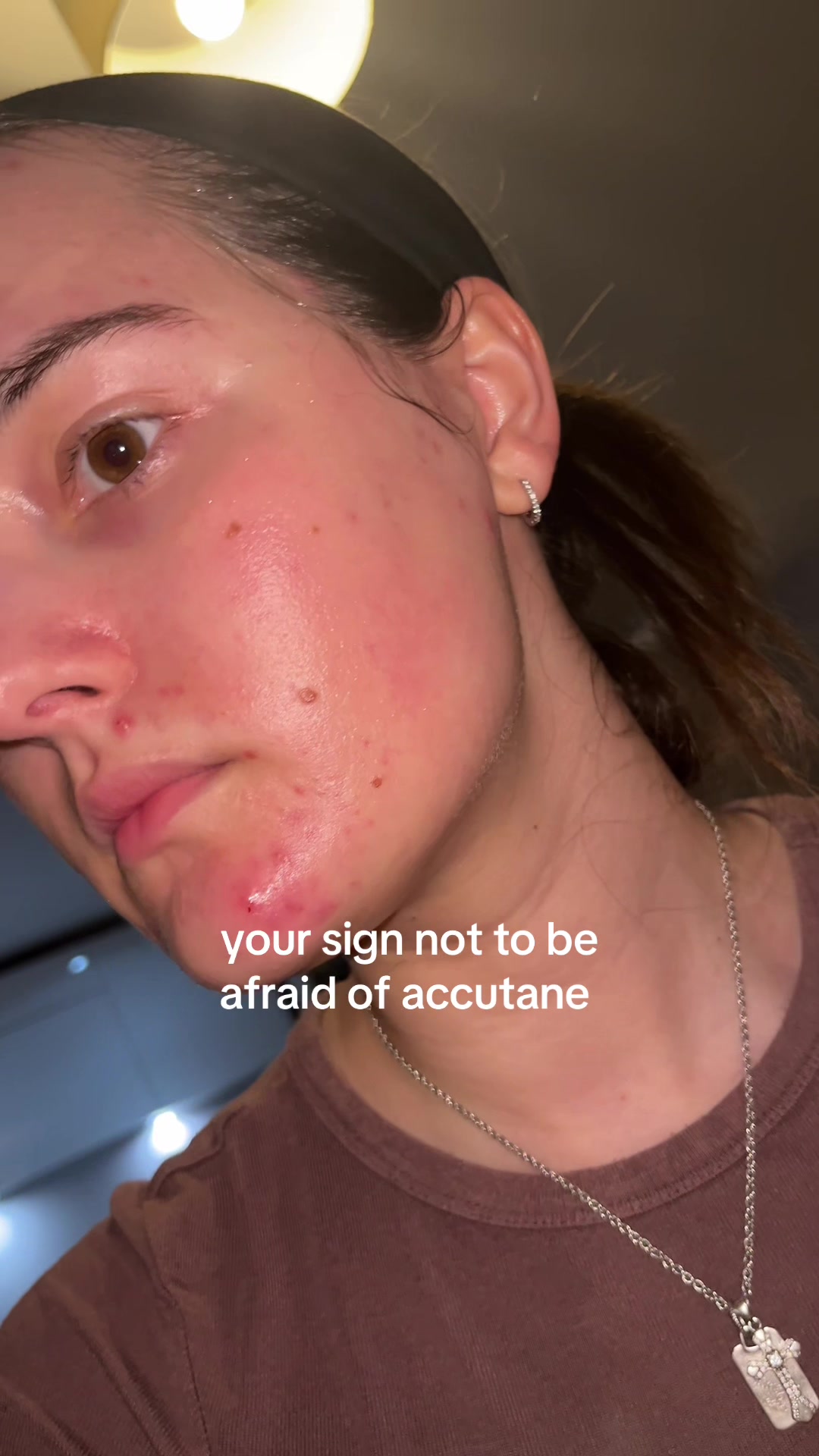 @andreea_skintok