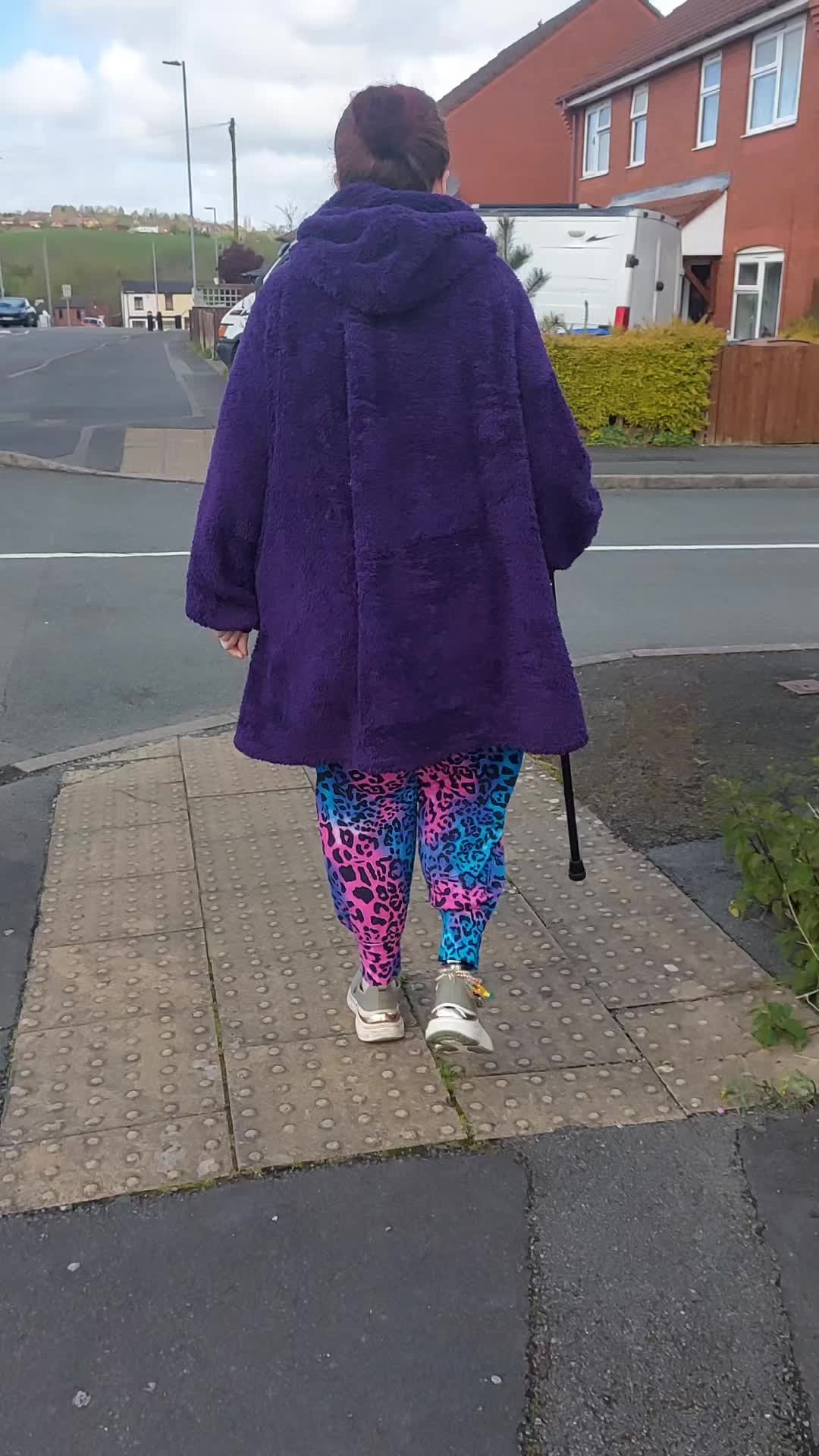 @OliviatheAmputee