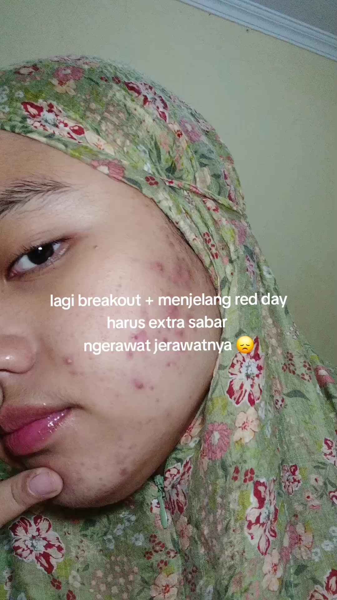 @Amini🕊️ | Lagi Reset Kulit