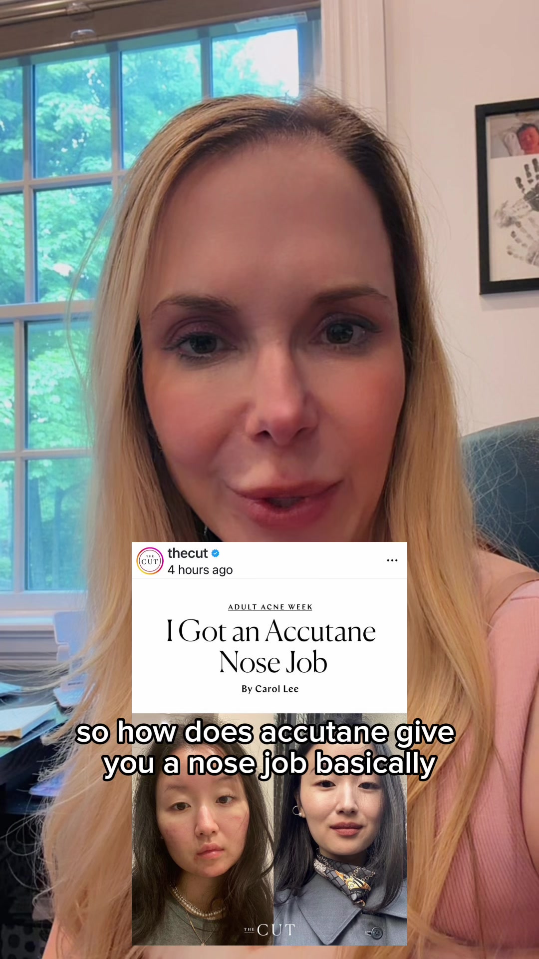 @Rosedermnyc