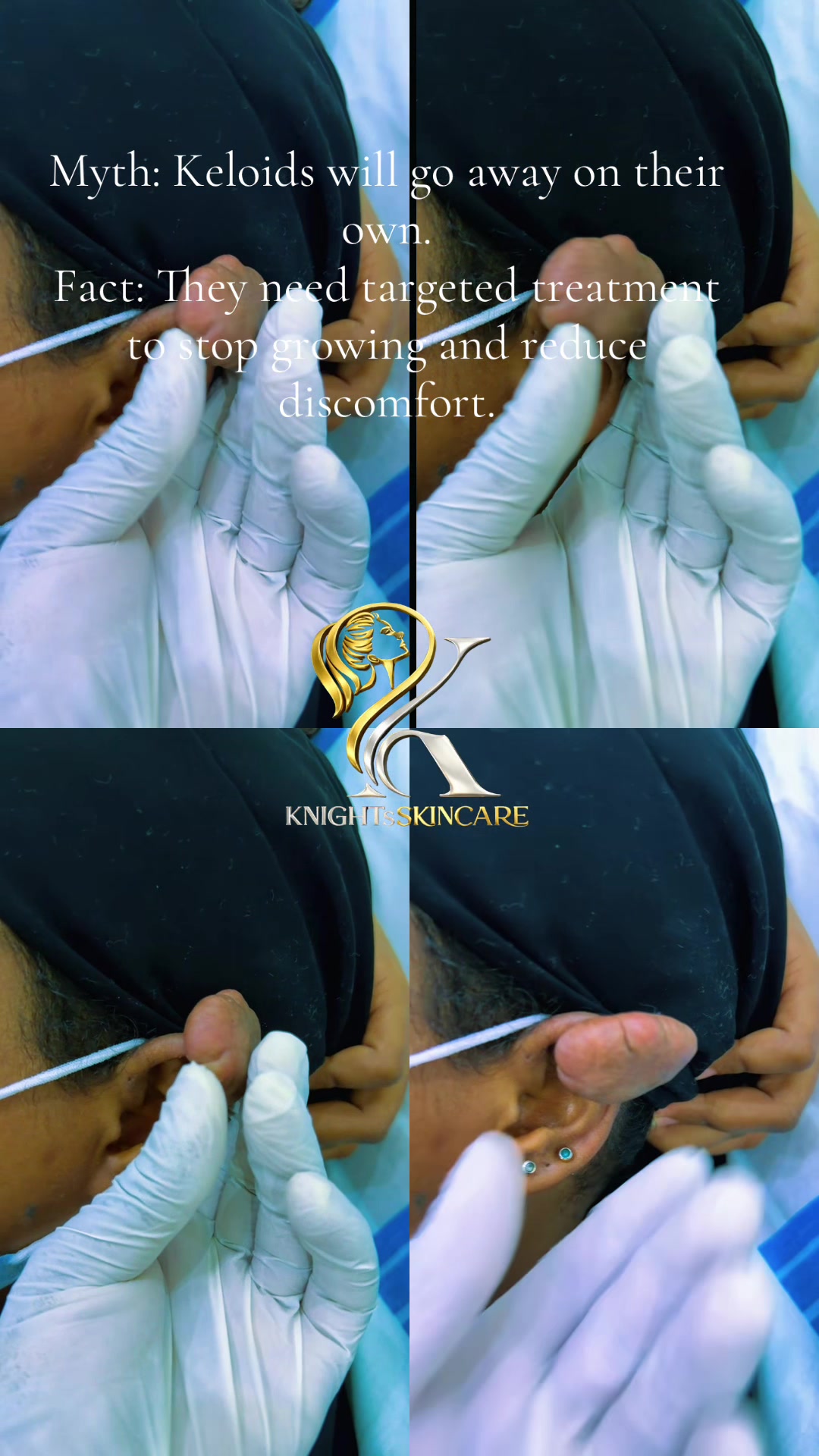 @KNIGHTS | SKINCARE | KENYA