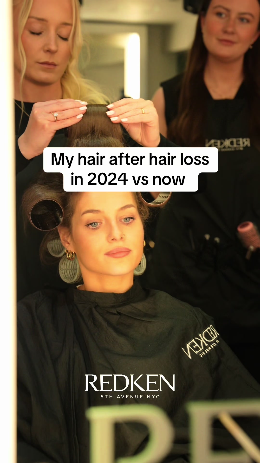 @Hairlossdiva