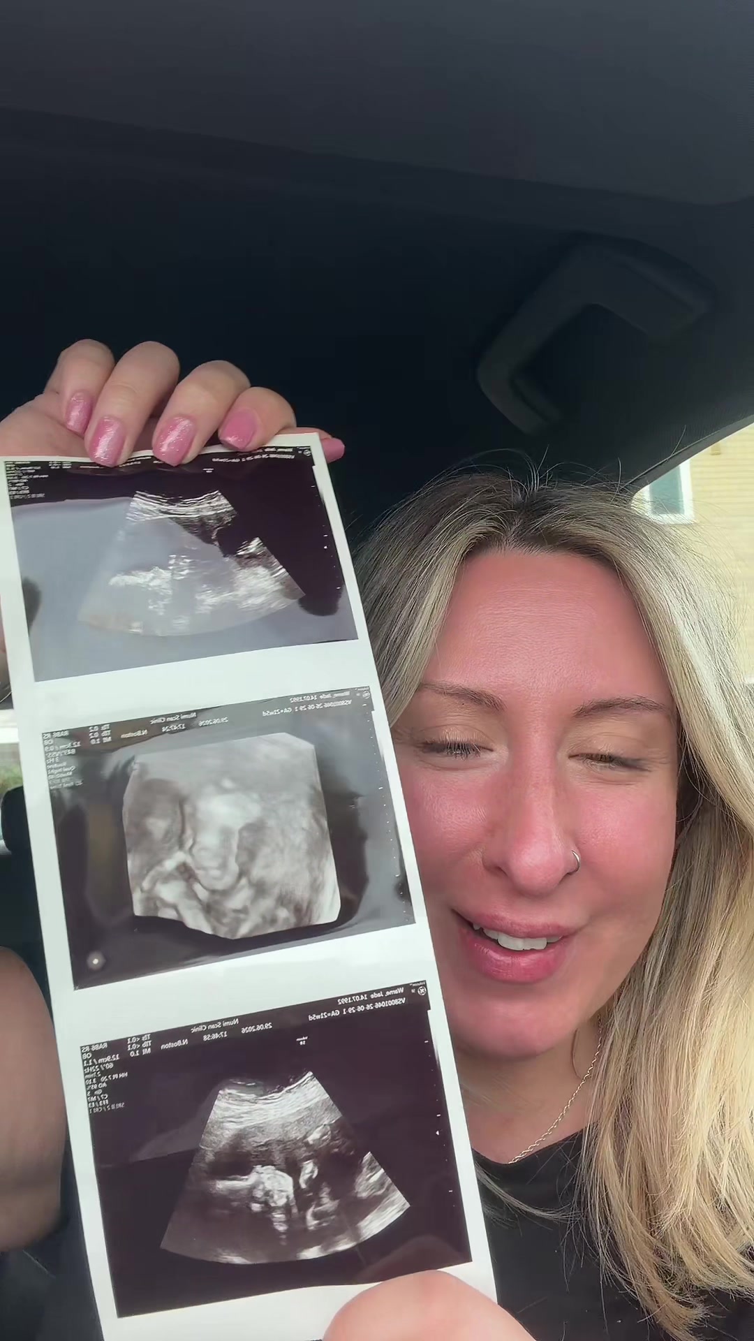 @Mrs Warne ✨Infertility journey