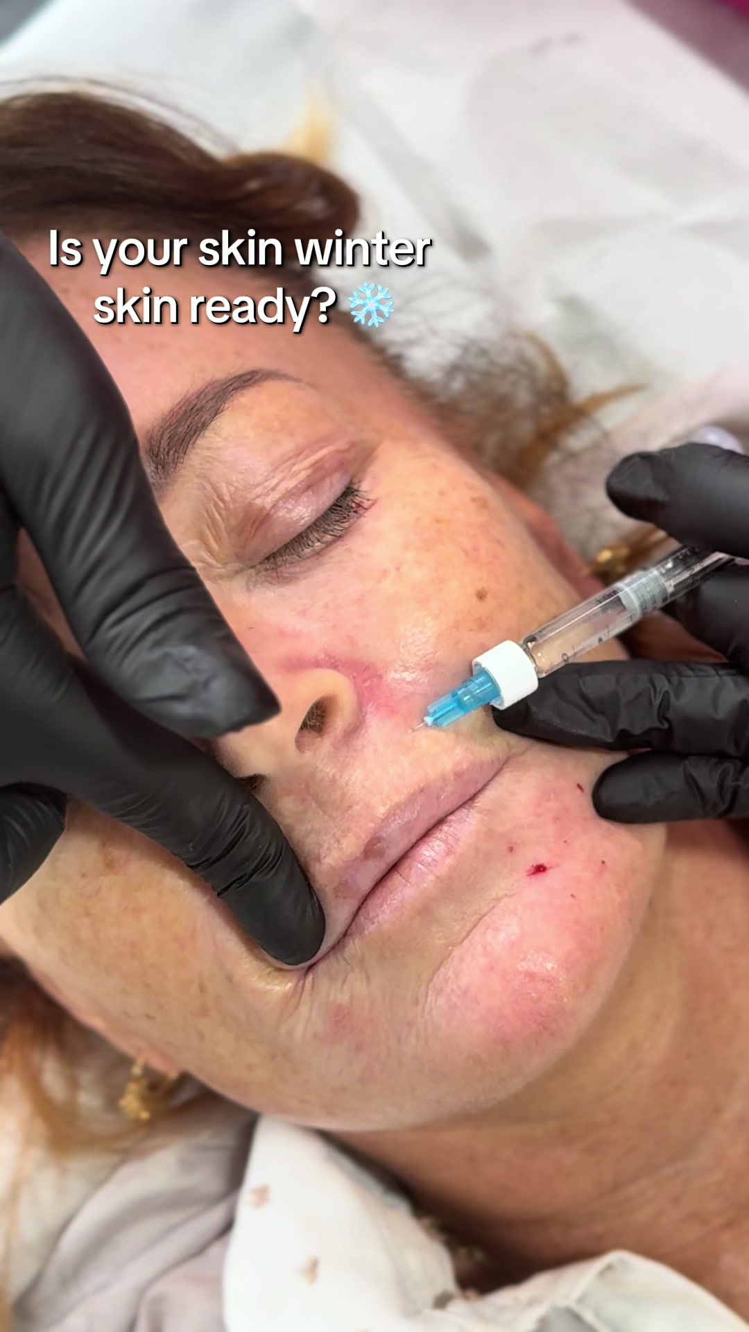 @Cosmetic Aesthetics Training