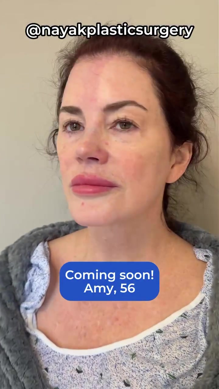 @NayakPlasticSurgery