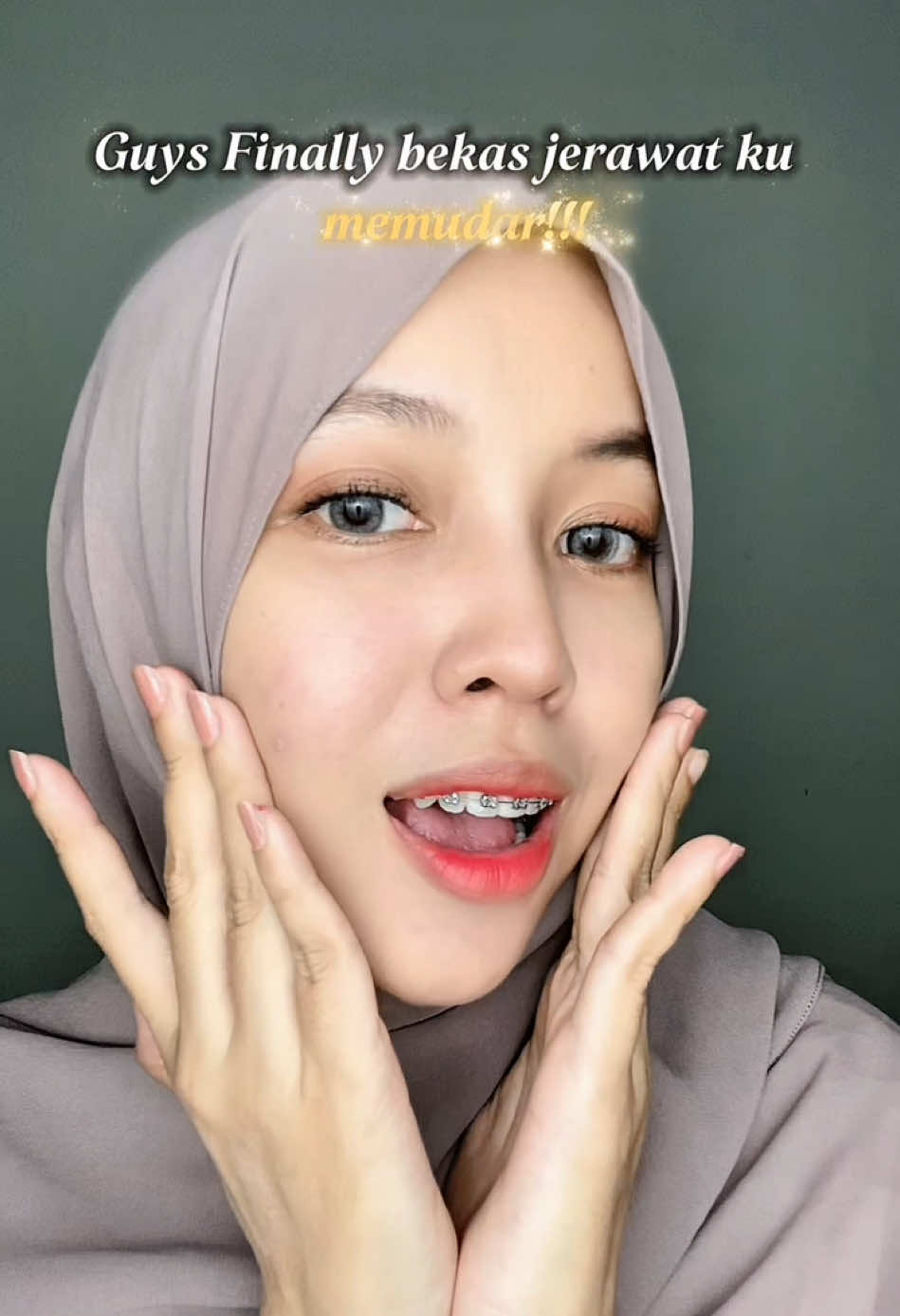 @NaNeNo