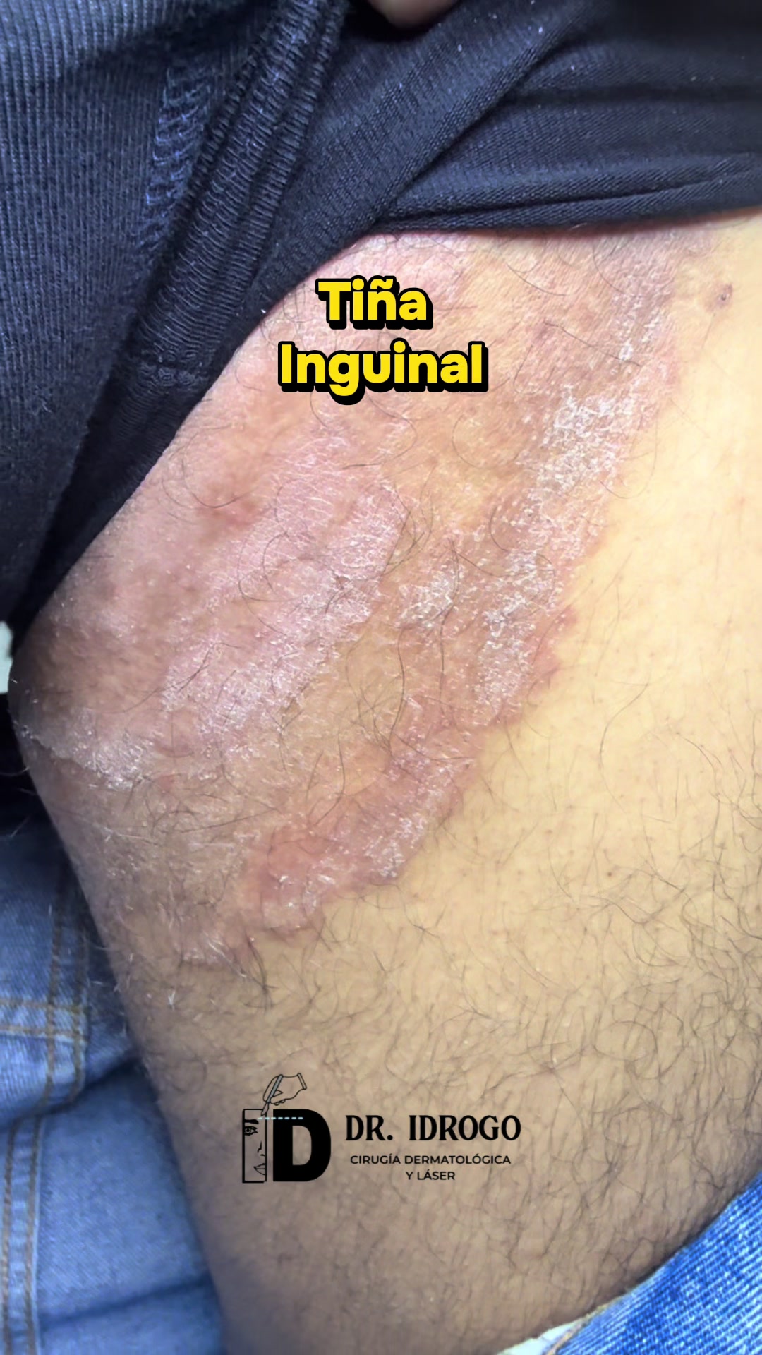 @dr.idrogodermatologo