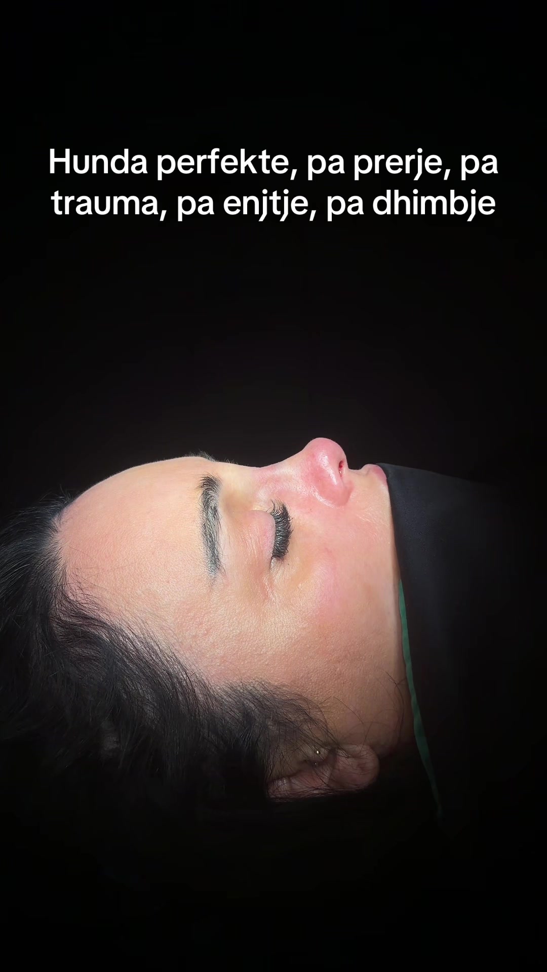 @rinoplasticatirana