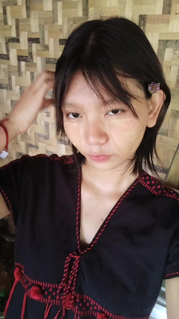 @๐ฏ๐ฝ๐พ๐๐๐ถ๐ ๐ฉ๐๐
